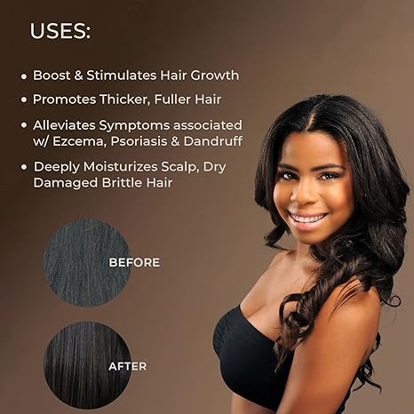 Sunny Isle The Original Jamaican Black Castor Oil - Image 3